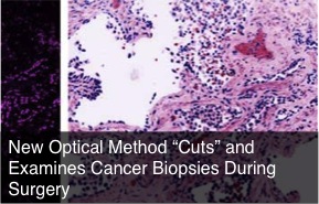 cancer biopsy surgery optical cuts